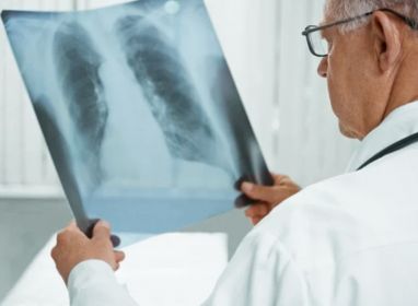 La tasa de tuberculosis se reduce a 40 casos por cada 100 mil habitantes