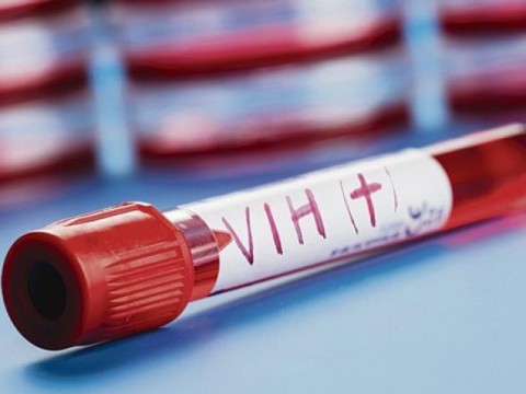 Desarrollan un nuevo tratamiento de acci&oacute;n prolongada para el VIH