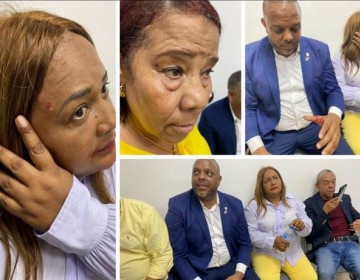 Unos 4 legisladores del PLD habr&iacute;an sido heridos por polic&iacute;as durante manifestaci&oacute;n