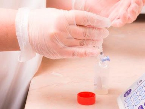 Un estudio detecta coronavirus en el semen de pacientes