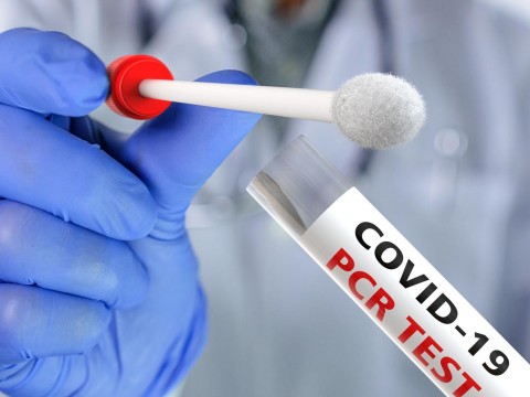 Salud P&uacute;blica reporta 279 nuevos casos de covid, sin defunciones