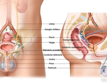 Los pacientes con c&aacute;ncer de pr&oacute;stata son cada vez m&aacute;s j&oacute;venes, seg&uacute;n experto