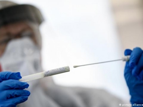 Salud P&uacute;blica inicia negociaci&oacute;n con farmac&eacute;uticas para apertura compra de pruebas antig&eacute;nicas
