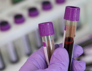 Prueba de Coronavirus cuestan 5,500 pesos en laboratorios privados