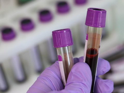 Prueba de Coronavirus cuestan 5,500 pesos en laboratorios privados