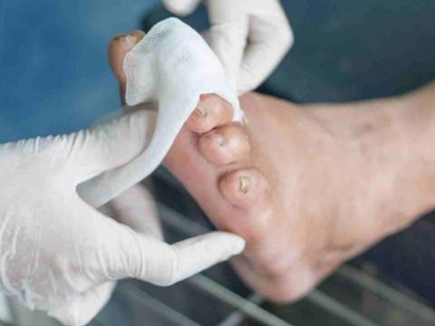El cuidado de los pies es vital en pacientes con diabetes
