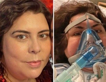 Enfermera con COVID-19 despierta de coma tras recibir tratamiento de Viagra