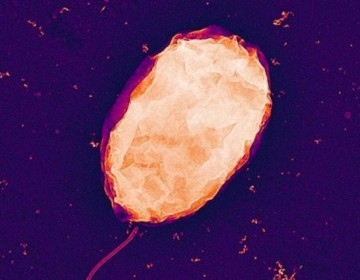 Una bacteria puede tener un gran impacto en procesar tierras raras
