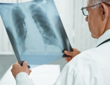 La tasa de tuberculosis se reduce a 40 casos por cada 100 mil habitantes
