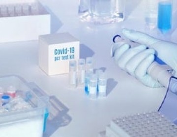 Gobierno Dominicano ha solicitado 53,300 pruebas para detectar el COVID-19