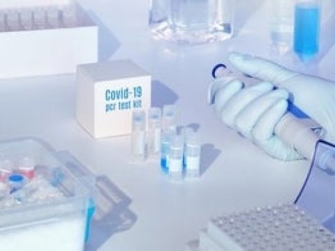 Gobierno Dominicano ha solicitado 53,300 pruebas para detectar el COVID-19