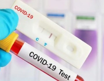 COVID-19 en RD: La positividad diaria es de 20.83 %