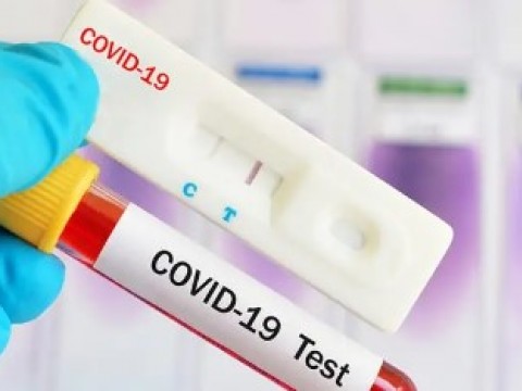 COVID-19 en RD: La positividad diaria es de 20.83 %