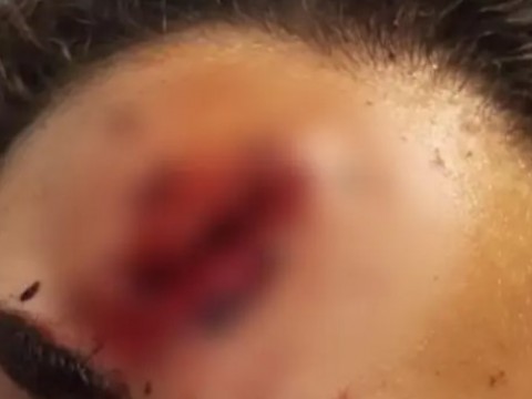 &laquo;Como no ten&iacute;a monedas agarr&oacute; un block&raquo;: limpiavidrios agrede mujer en el DN