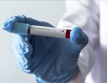 Casos de COVID-19 en el pa&iacute;s aumentan a 3,286 