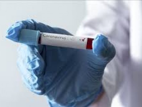 Casos de COVID-19 en el pa&iacute;s aumentan a 3,286 