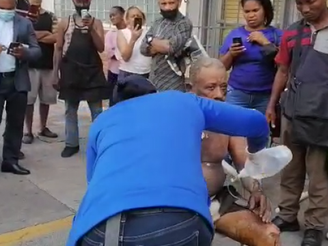 Hombre que se prendi&oacute; fuego est&aacute; en cuidados intensivos