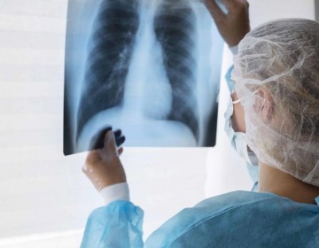 Con inmunoterapia se curan m&aacute;s pacientes de c&aacute;ncer de mama triple negativo, seg&uacute;n estudio