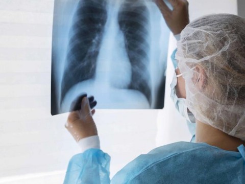 Con inmunoterapia se curan m&aacute;s pacientes de c&aacute;ncer de mama triple negativo, seg&uacute;n estudio