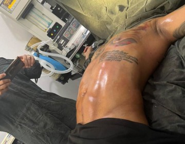 El Mayor Cl&aacute;sico dice que pocos urbanos admiten sus retoques tras someterse a una cirug&iacute;a est&eacute;tica