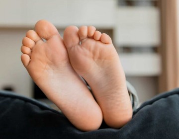 Amputaciones por pie diab&eacute;tico, una de las consecuencias graves de la enfermedad