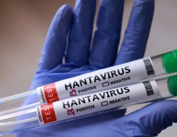  Suben a once los casos de hantavirus, pero la OMS descarta riesgo elevado