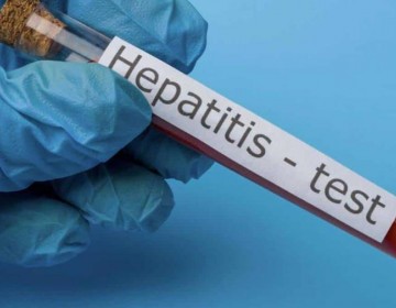 OMS: La hepatitis podr&iacute;a ser m&aacute;s letal que la malaria, la tuberculosis y el sida en 2040