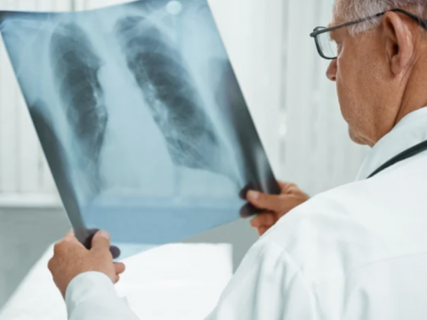 Casos de tuberculosis infantil aumentan un 10 % en Europa