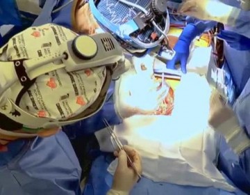 M&eacute;dicos estadounidenses implantan por primera vez un coraz&oacute;n de cerdo a un humano