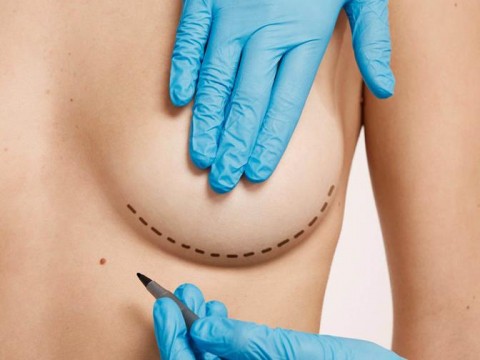 C&aacute;ncer de mama: siete consejos para enfrentar el cambio f&iacute;sico tras una mastectom&iacute;a