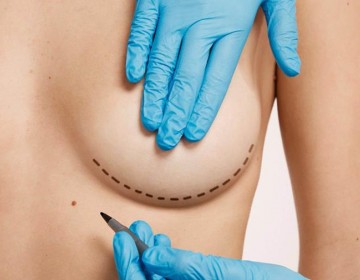 C&aacute;ncer de mama: siete consejos para enfrentar el cambio f&iacute;sico tras una mastectom&iacute;a
