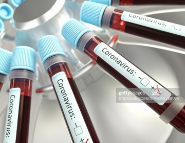El Seguro Familiar de Salud cubrir&aacute; pruebas coronavirus indicadas por m&eacute;dicos