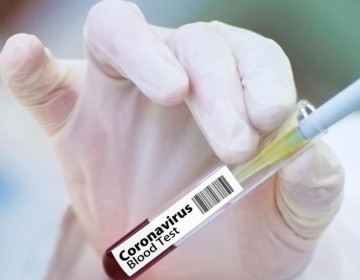 Salud reporta 27 nuevos contagios de covid en las &uacute;ltimas horas