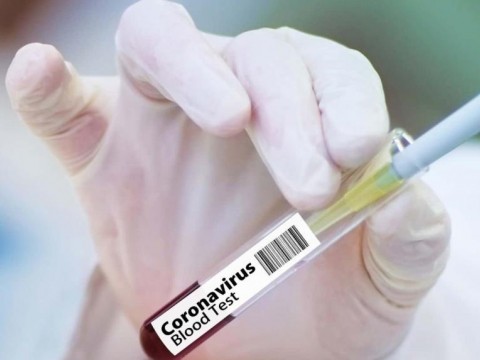 Salud reporta 27 nuevos contagios de covid en las &uacute;ltimas horas