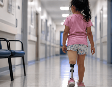 &laquo;Quiero mi pierna de vuelta&raquo;: El trauma de la infancia truncada por un accidente