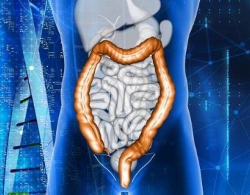 C&aacute;ncer de colon, cada vez m&aacute;s diagnosticado en pacientes j&oacute;venes