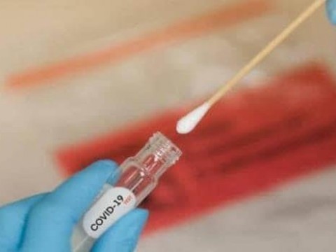 Salud P&uacute;blica reporta 2,744 casos activos de COVID-19 en el pa&iacute;s