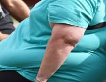 Al menos el 40% de los dominicanos con COVID-19  son obesos