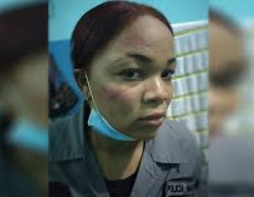 Agente Disleidy Heredia Figue&shy;roa se querella contra diputado por agresi&oacute;n f&iacute;sica