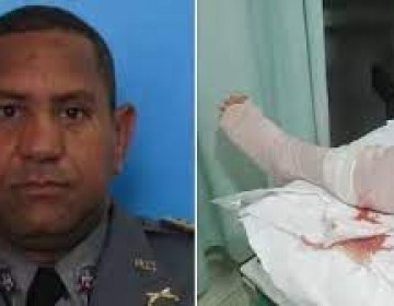 Hieren de bala a mayor PN en San Francisco Macor&iacute;s