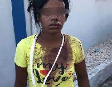 Mujer es golpeada por atracadores en Barahona