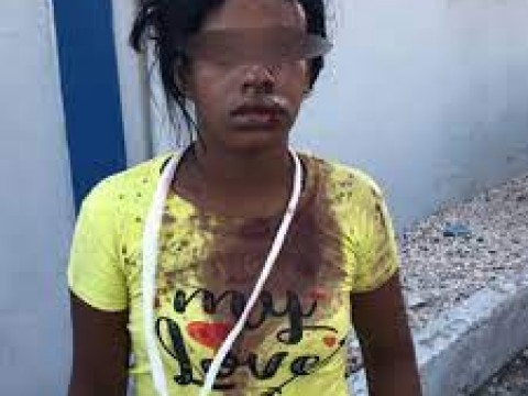 Mujer es golpeada por atracadores en Barahona