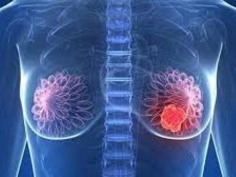 Desinformaci&oacute;n es la principal causa de detecci&oacute;n tard&iacute;a del c&aacute;ncer de mama