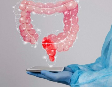 El c&aacute;ncer colorrectal se protege de la inmunoterapia con un doble escudo, seg&uacute;n un estudio