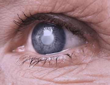 Efem&eacute;ride de hoy: D&iacute;a Mundial del Glaucoma