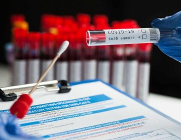 Un error en pruebas de covid en laboratorio brit&aacute;nico pudo causar 20 muertes