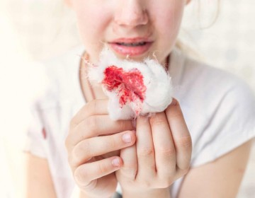Piden ampliar cobertura de tratamiento innovador para ni&ntilde;os con hemofilia