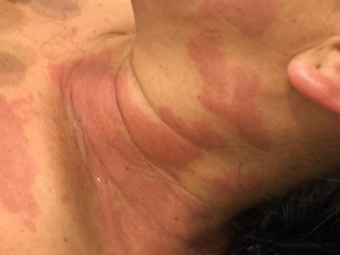 Medusas tienen en zozobra a nadadores y surfistas en playa de Boca Chica
