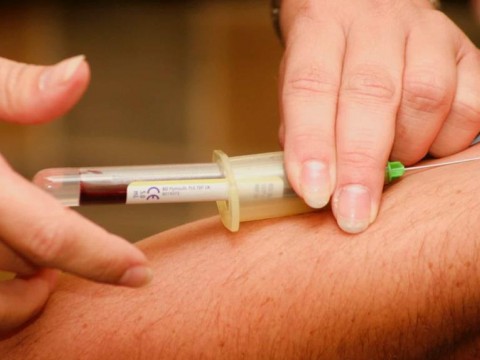 Un an&aacute;lisis de sangre para identificar un biomarcador del alzh&eacute;imer