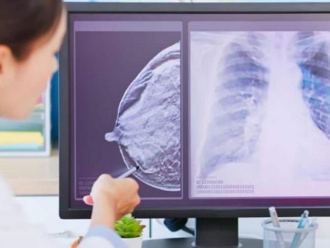 La inteligencia artificial detecta el c&aacute;ncer de mama cinco a&ntilde;os antes de que se desarrolle